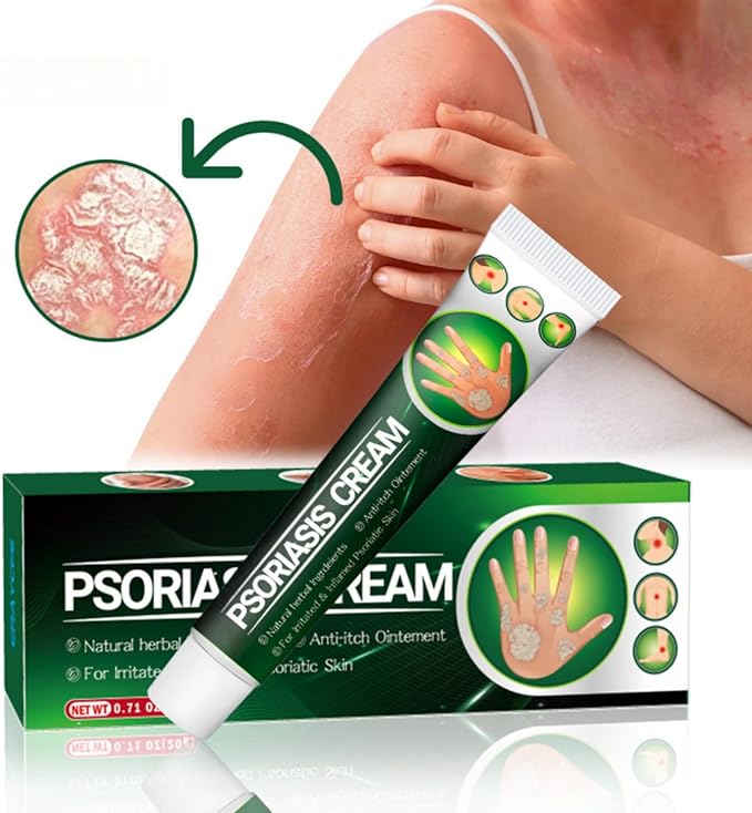 Psoriasis Cream - Herbal Plant Extracts 20g